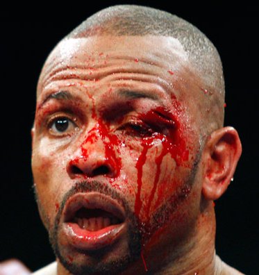 roy-jones-jr-cut-eye.jpg